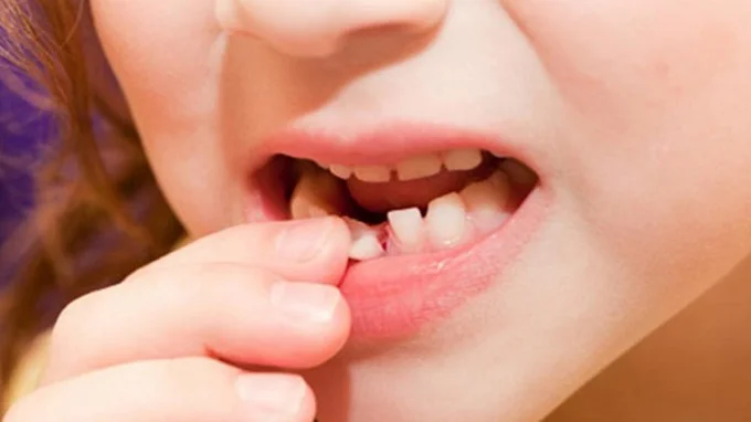 Nằm mơ rụng răng là điềm gì và đánh số nào may mắn nhất