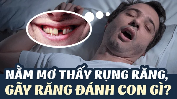Nằm mơ rụng răng là điềm gì và đánh số nào may mắn nhất 2 rụng răng là điềm gì